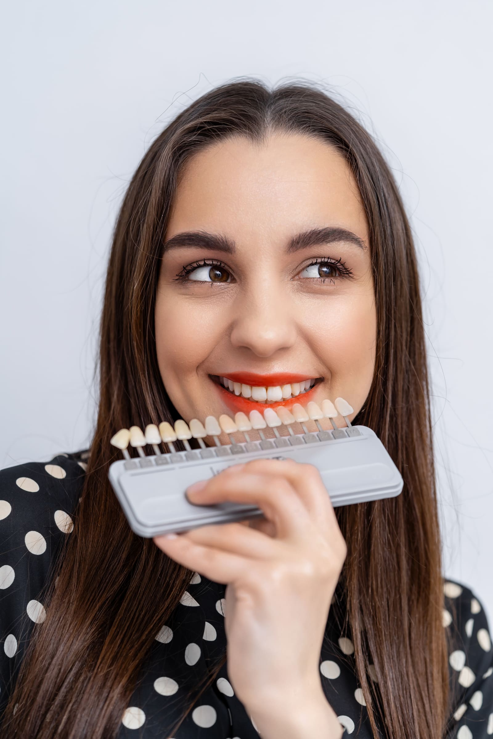 E-max Veneers treatment at Dental Art Alanya